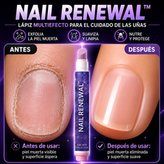 Nail Renewal™ – Lápiz Multiefecto para Cutículas y Cuidado de Uñas 3